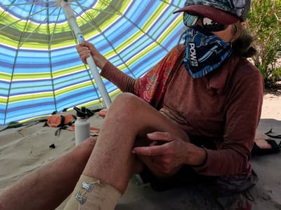 Day 5 - Carbon Canyon (Mile 64) to just shy of Zoroaster Rapid (Mile 85): My Boo Boo during a sandstorm