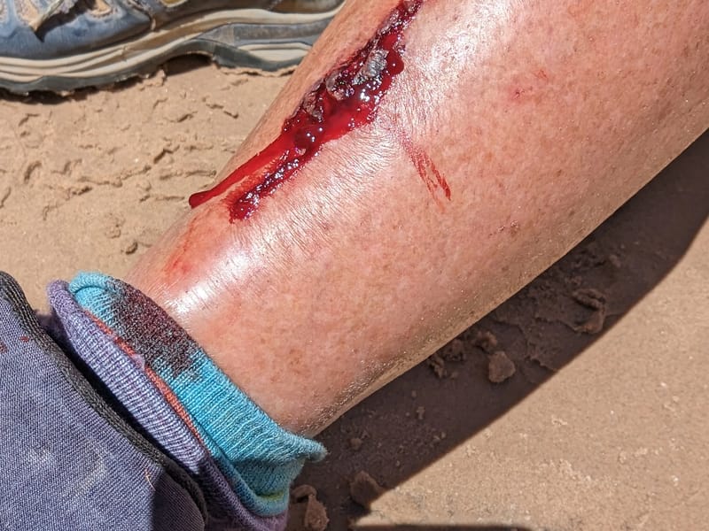 My shin colliding with some metamorphic schist